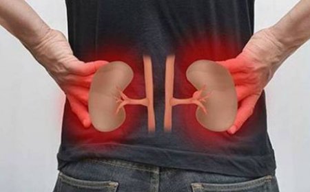 طبيب سعودي يحذر وبشدة من شرب هذه الادوية عند احساسك بالصداع سبب رئيسي بالفشل الكلوي