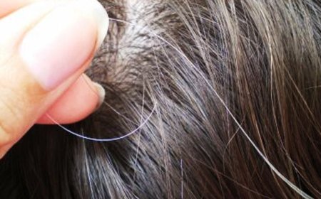 سعودي يكشف عن طريقة جبارة تُخلصك من علامات الشيب المبكر