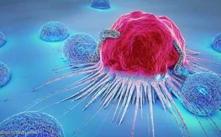 طبيب سعودي يكشف عن 5 أطعمة تسبب السرطان عند استخدامها يومياً