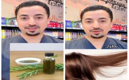 صيدلي سعودي يكشف عن أفضل زيت لإنبات الشعر وعلاج الصلع الوراثي