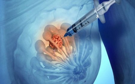 اكتشاف أول علاج لسرطان الأمعاء.. وتحديد موعد طرحه في الأسواق