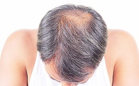 ستة فيتامينات تساعد في تقوية الشعر وتمنع تساقطه.. تعرف عليها