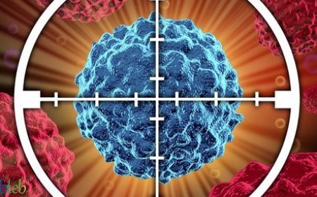 تخنق الورم حتى الموت.. ابتكار تركيبة علاج تقضي على السرطان خلال أيام !