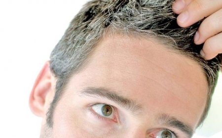 3 أسباب للشيب المبكر تجنّبها