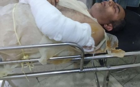 عازف يمني شهير يخضع لإجراء عملية جراحية