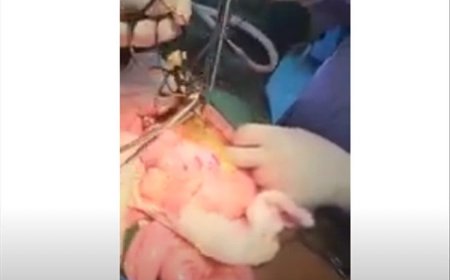 حدث لايصدق داخل احد المستشفيات في صنعاء