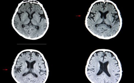مرض خطير يهدد الأطفال حديثي الولادة غربي اليمن.. ومناشدات بتدخل عاجل