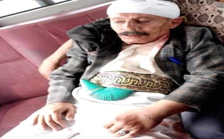 مدرس وإمام مسجد يتعرض للاعتداء المبرح في محافظة إب