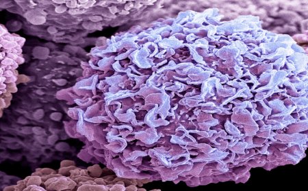 تفشي لفيروس ماربورغ في إثيوبيا… ومخاوف من وصوله إلى اليمن