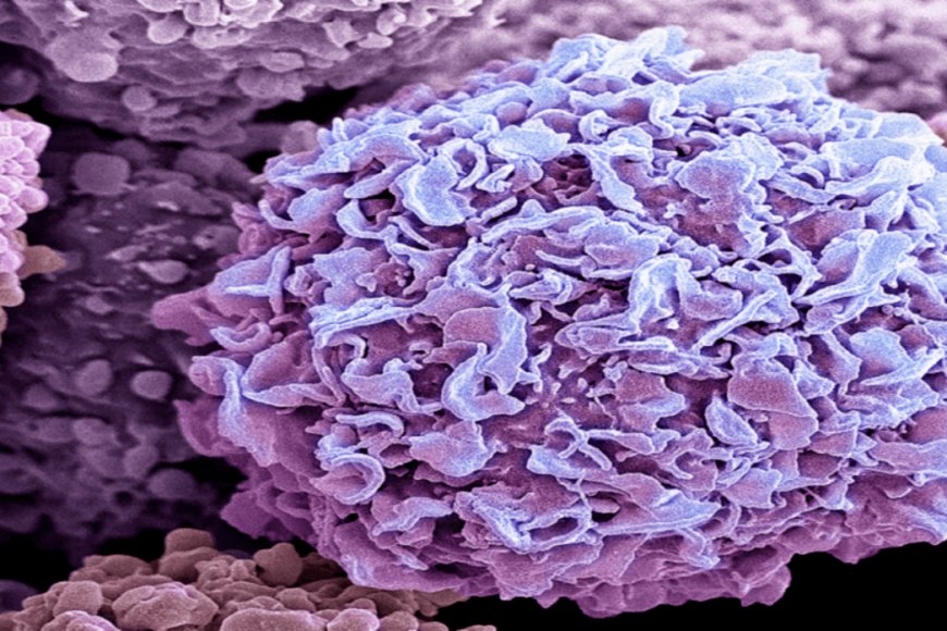 تفشي لفيروس ماربورغ في إثيوبيا… ومخاوف من وصوله إلى اليمن