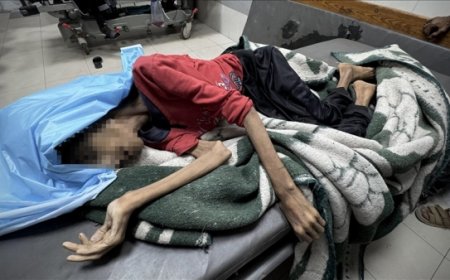 غزة تموت جوعاً.. وفاة فتاة بعد انخفاض وزنها إلى النصف