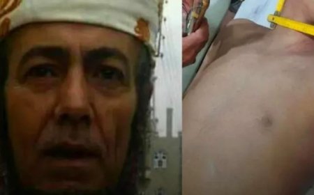 ضحية جديدة في إب.. وفاة شاب أثناء خضوعه لجلسة رقية شرعية