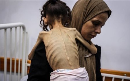 مسؤول أممي: صور الجوعى في غزة تمزق القلب ولا تحتمل