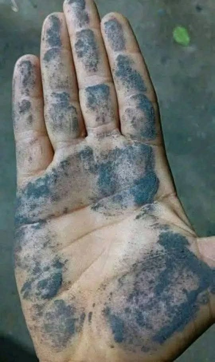 تحذيرات صحية عاجلة في اليمن مع تساقط الرماد البركاني القادم من إثيوبيا