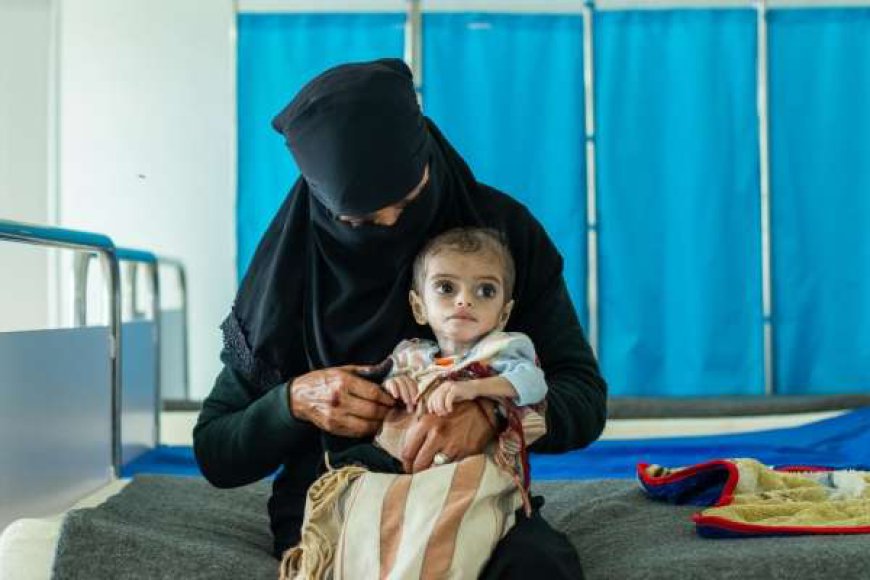 منظمة أممية: سوء التغذية يحرم ملايين الأطفال في ‎اليمن من صحتهم