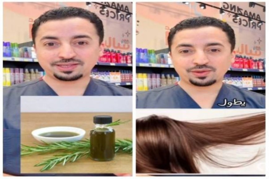 صيدلي سعودي يكشف عن أفضل زيت لإنبات الشعر وعلاج الصلع الوراثي