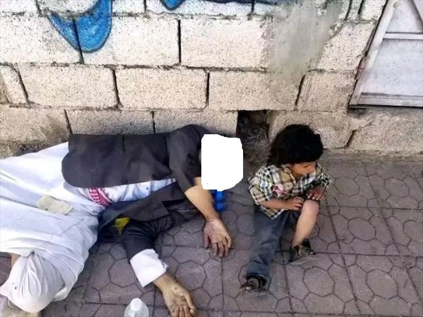 الجوع يودي بحياة مواطن في إب وطفله يحتضنه على قارعة الطريق