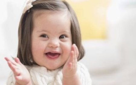 تقدم علمي واعد نحو علاج متلازمة داون بتقنية تعديل الجينات