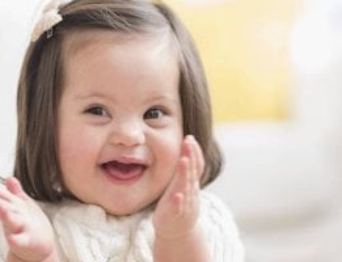 تقدم علمي واعد نحو علاج متلازمة داون بتقنية تعديل الجينات