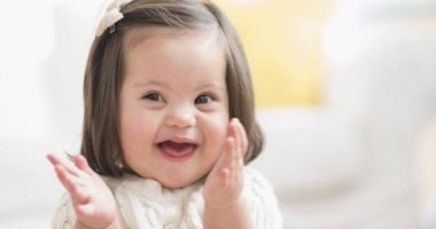 تقدم علمي واعد نحو علاج متلازمة داون بتقنية تعديل الجينات