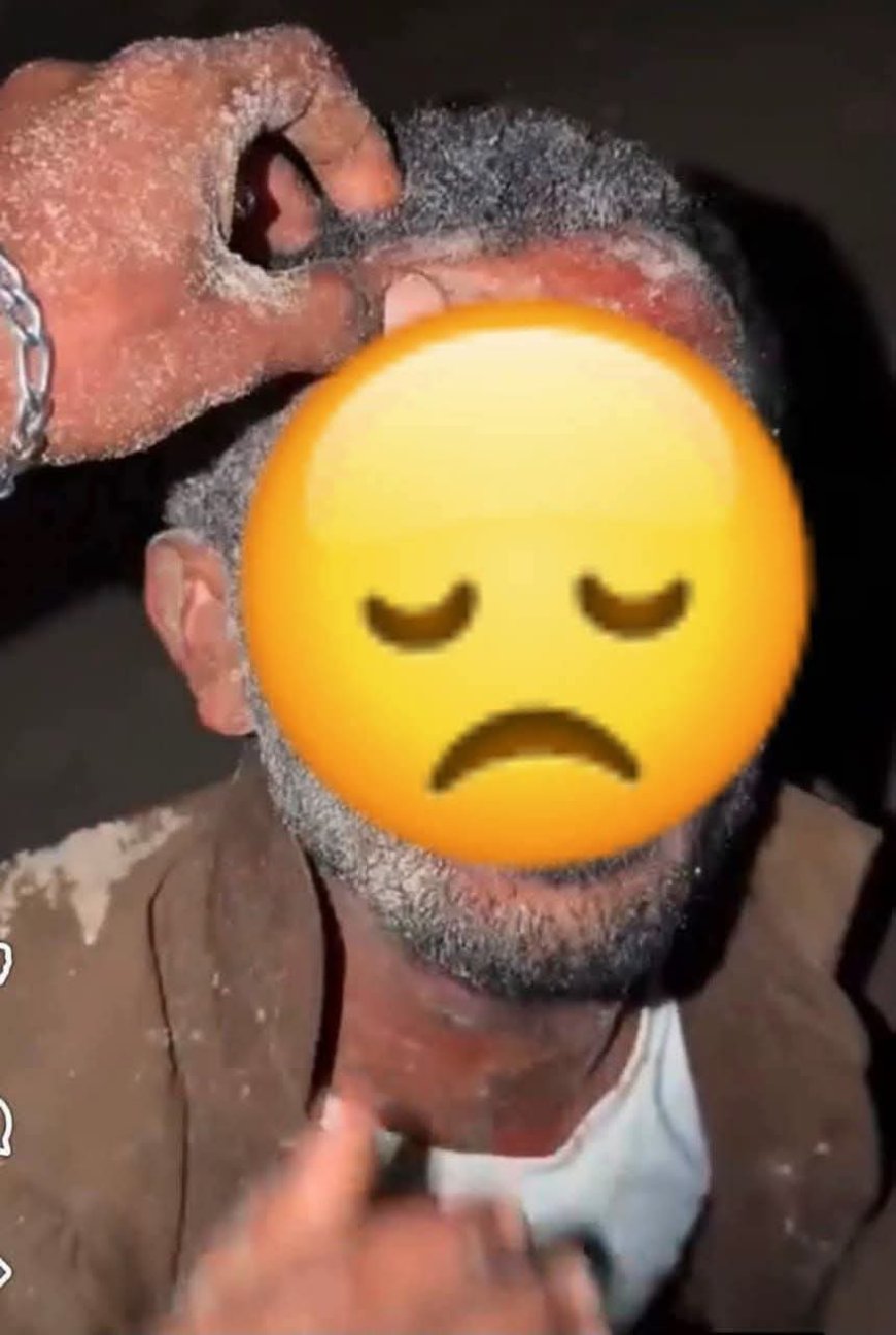 بعد تداول المقطع.. الأجهزة الأمنية بروكب تضبط المتهم بالاعتداء على أحد المواطنين